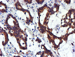 NDUFB9 Antibody in Immunohistochemistry (Paraffin) (IHC (P))