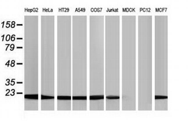 NDUFB9 Antibody in Western Blot (WB)