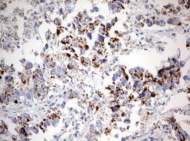 NDUFS2 Antibody in Immunohistochemistry (Paraffin) (IHC (P))