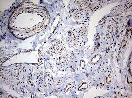 NDUFS2 Antibody in Immunohistochemistry (Paraffin) (IHC (P))