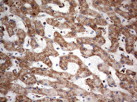 NDUFS2 Antibody in Immunohistochemistry (Paraffin) (IHC (P))