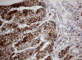 NDUFS2 Antibody in Immunohistochemistry (Paraffin) (IHC (P))