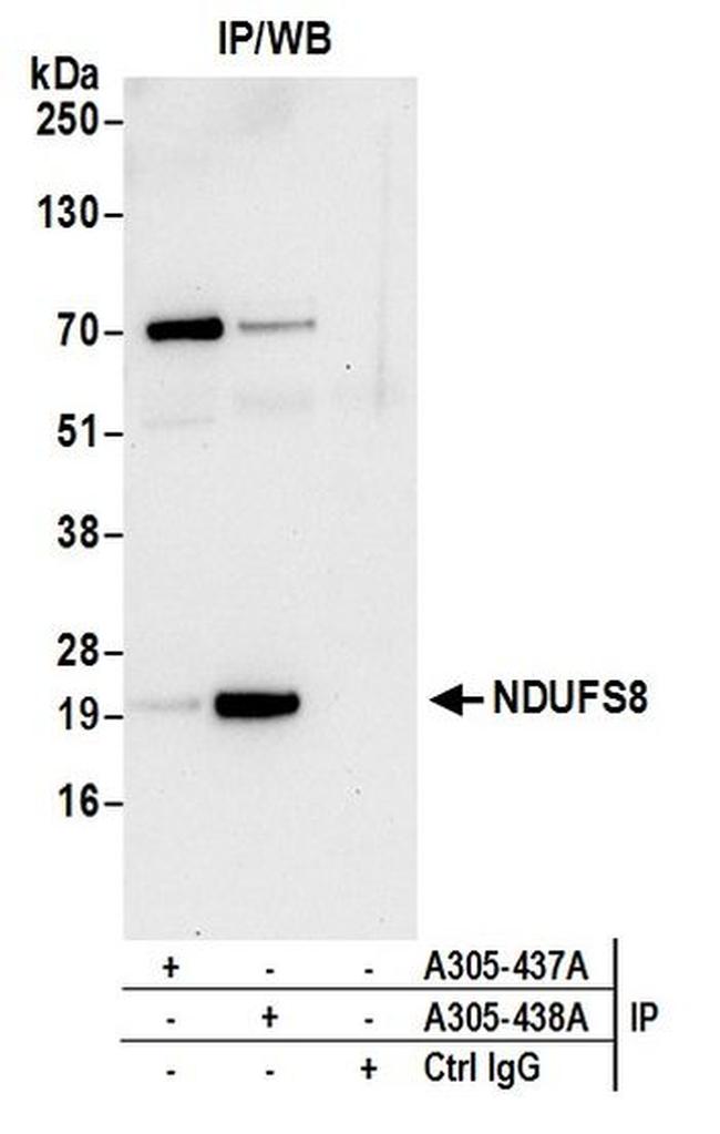 NDUFS8 Antibody in Western Blot (WB)