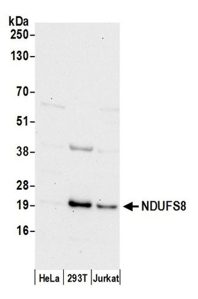 NDUFS8 Antibody in Western Blot (WB)