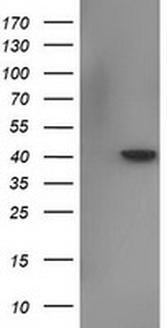 NECAB1 Antibody in Western Blot (WB)