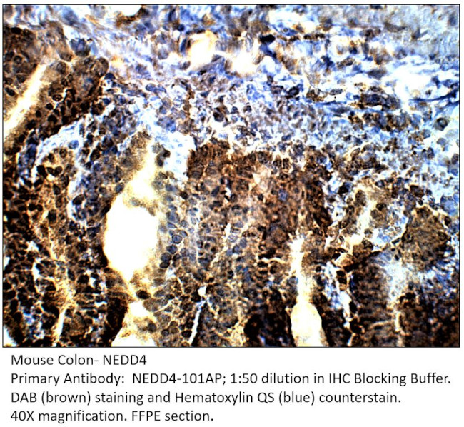 NEDD4 Antibody in Immunohistochemistry (IHC)