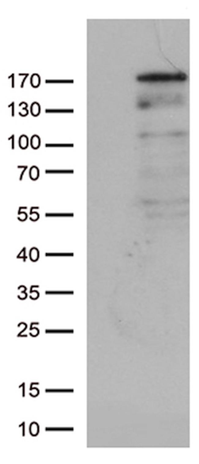 NEDD4 Antibody in Western Blot (WB)