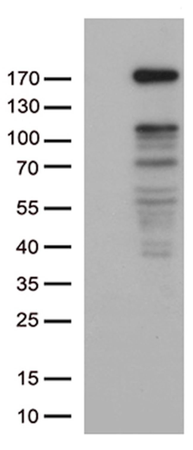 NEDD4 Antibody in Western Blot (WB)