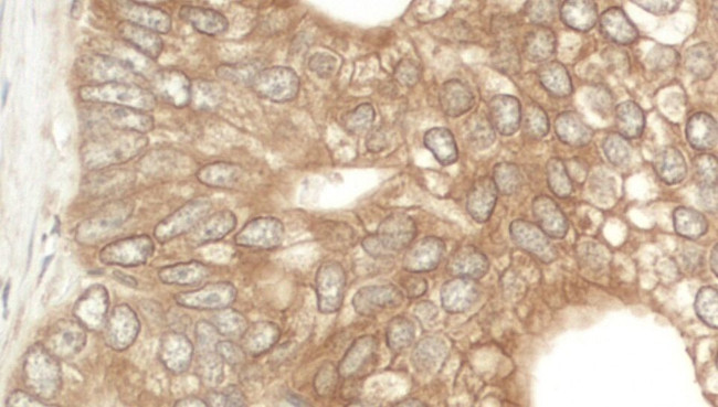 NEDD4L Antibody in Immunohistochemistry (IHC)