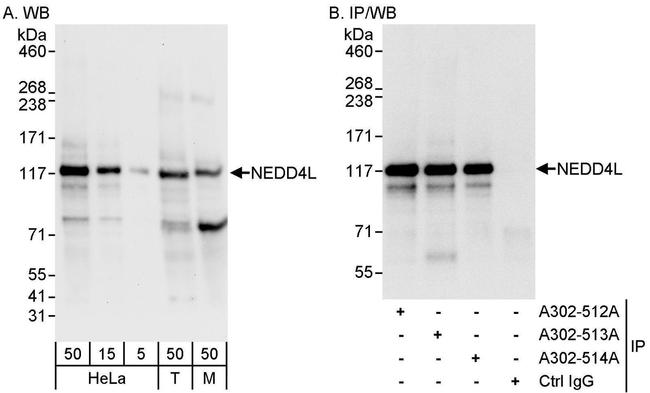 NEDD4L Antibody in Western Blot (WB)