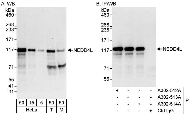 NEDD4L Antibody in Western Blot (WB)