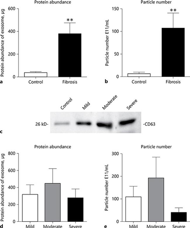 CD63 Antibody in Western Blot (WB)