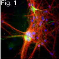 NF-H Antibody in Immunocytochemistry (ICC/IF)