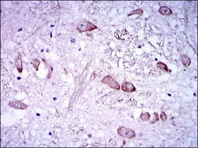 NF-H Antibody in Immunohistochemistry (Paraffin) (IHC (P))