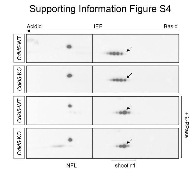 NEFL Antibody in Western Blot (WB)