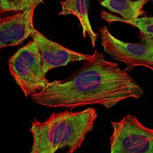 NEFL Antibody in Immunocytochemistry (ICC/IF)