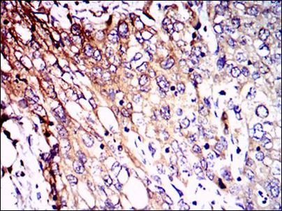 NEFL Antibody in Immunohistochemistry (Paraffin) (IHC (P))