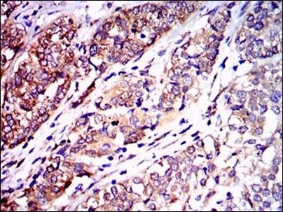 NEFL Antibody in Immunohistochemistry (Paraffin) (IHC (P))