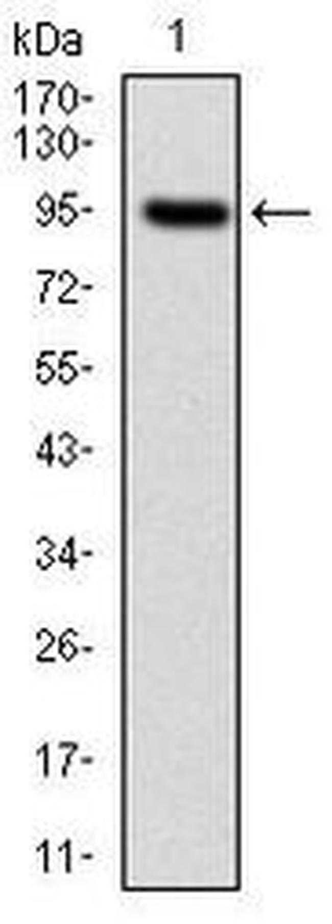 NEFL Antibody in Western Blot (WB)