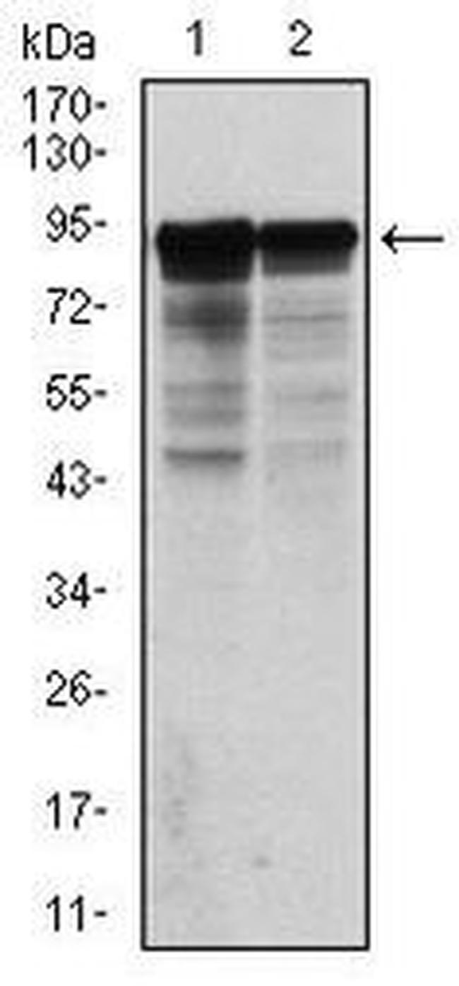 NEFL Antibody in Western Blot (WB)