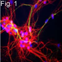 NEFM Antibody in Immunohistochemistry (IHC)