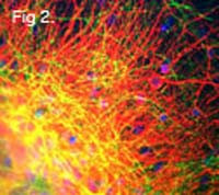 NEFM Antibody in Immunohistochemistry (IHC)