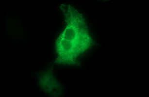 NEFM Antibody in Immunocytochemistry (ICC/IF)