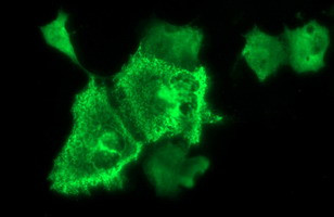 NEFM Antibody in Immunocytochemistry (ICC/IF)