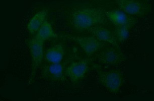 NEFM Antibody in Immunocytochemistry (ICC/IF)