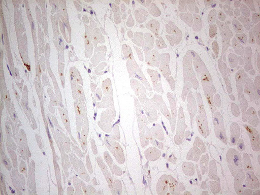 NEFM Antibody in Immunohistochemistry (Paraffin) (IHC (P))