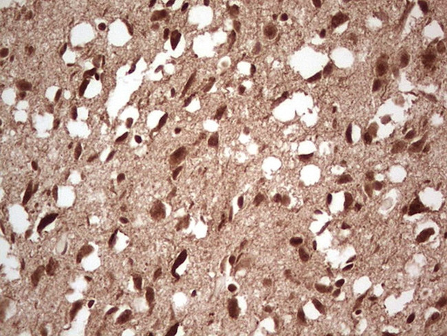 NEFM Antibody in Immunohistochemistry (Paraffin) (IHC (P))