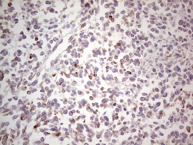 NEFM Antibody in Immunohistochemistry (Paraffin) (IHC (P))