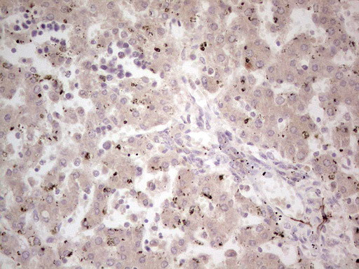 NEFM Antibody in Immunohistochemistry (Paraffin) (IHC (P))