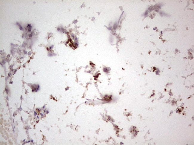 NEFM Antibody in Immunohistochemistry (Paraffin) (IHC (P))