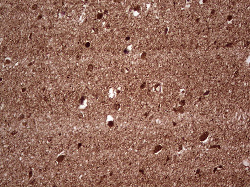 NEFM Antibody in Immunohistochemistry (Paraffin) (IHC (P))