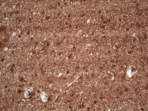 NEFM Antibody in Immunohistochemistry (Paraffin) (IHC (P))