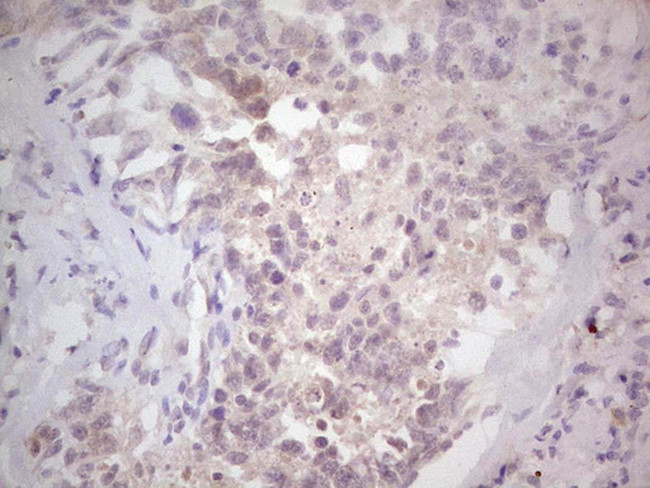 NEFM Antibody in Immunohistochemistry (Paraffin) (IHC (P))