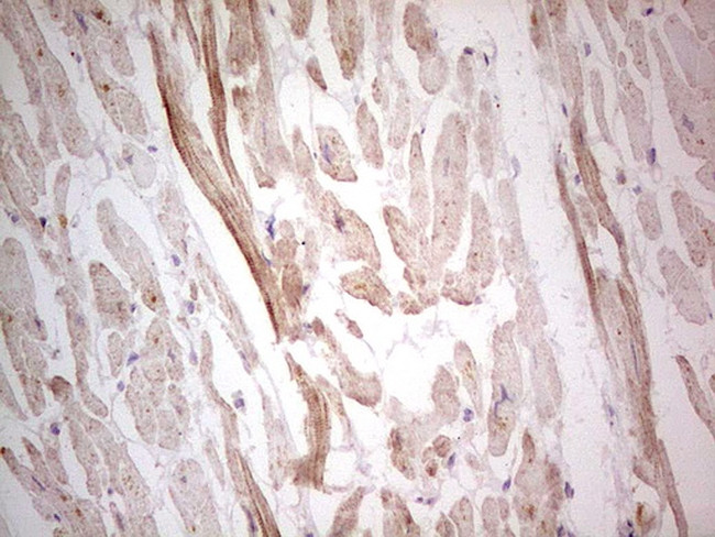 NEFM Antibody in Immunohistochemistry (Paraffin) (IHC (P))