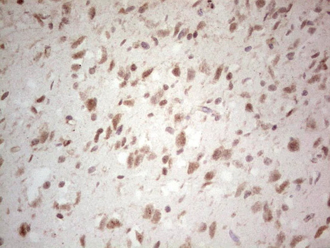 NEFM Antibody in Immunohistochemistry (Paraffin) (IHC (P))