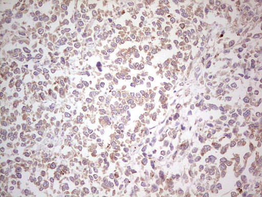 NEFM Antibody in Immunohistochemistry (Paraffin) (IHC (P))