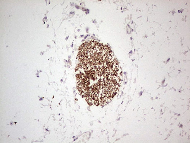 NEFM Antibody in Immunohistochemistry (Paraffin) (IHC (P))