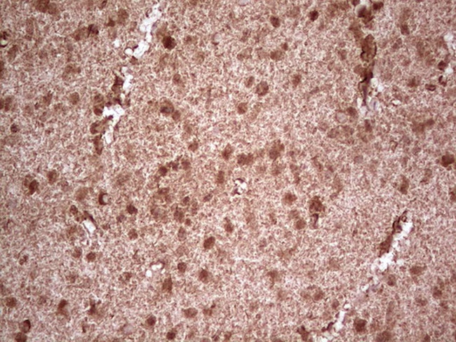 NEFM Antibody in Immunohistochemistry (Paraffin) (IHC (P))