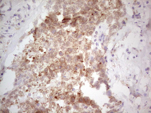 NEFM Antibody in Immunohistochemistry (Paraffin) (IHC (P))