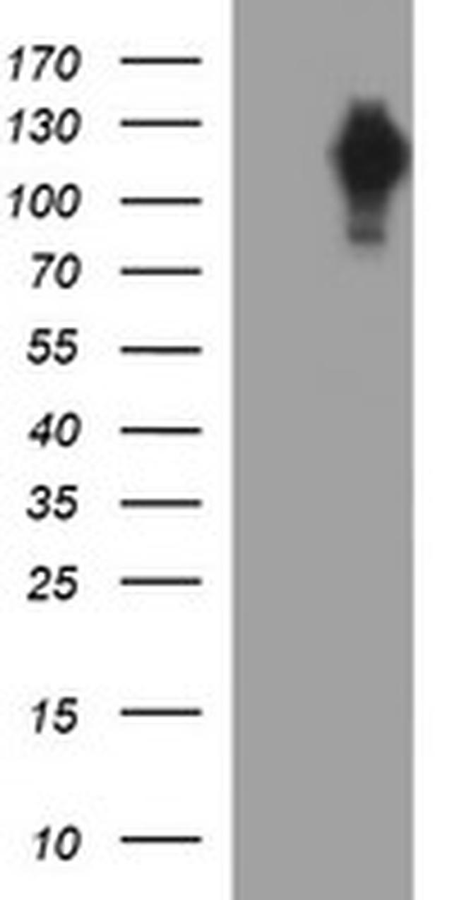 NEFM Antibody in Western Blot (WB)