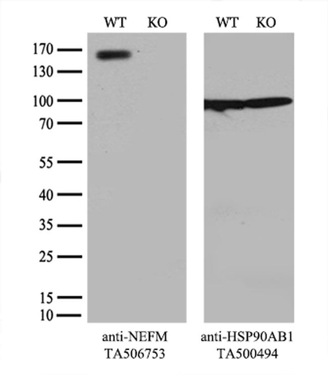 NEFM Antibody in Western Blot (WB)