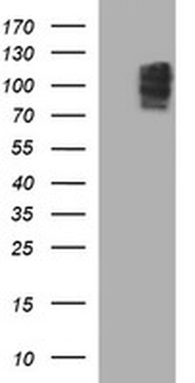 NEFM Antibody in Western Blot (WB)