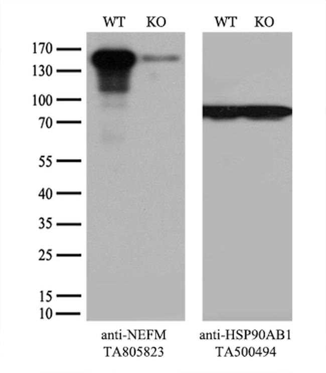 NEFM Antibody in Western Blot (WB)