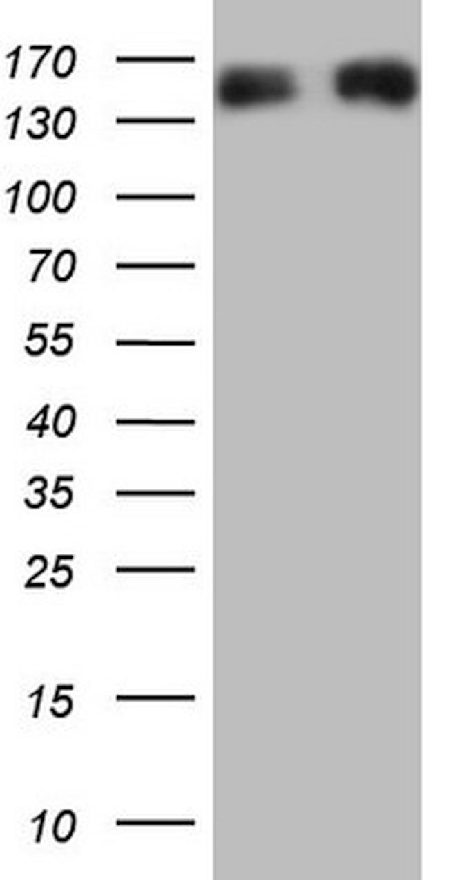 NEFM Antibody in Western Blot (WB)