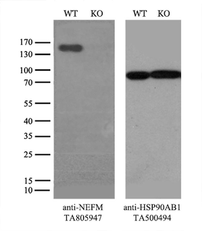 NEFM Antibody in Western Blot (WB)