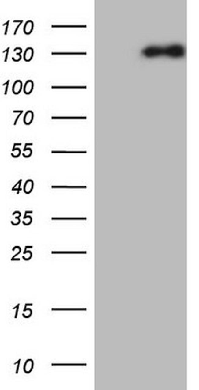 NEFM Antibody in Western Blot (WB)